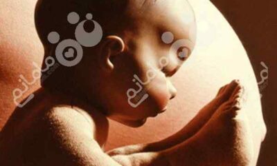 حالت بریچ نوزاد چه تاثیری در زایمان دارد؟ (بخش اول)