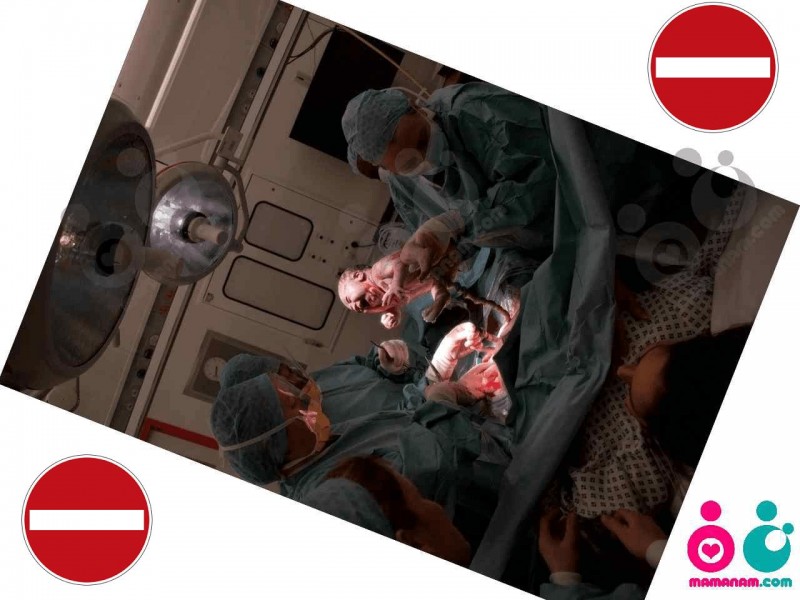 sezariyan03.jpg