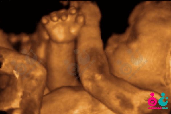 sonografi1.jpg