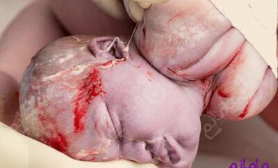 زایمان طبیعی و 5 تکنیک مقابله با نیروهای بازدارنده