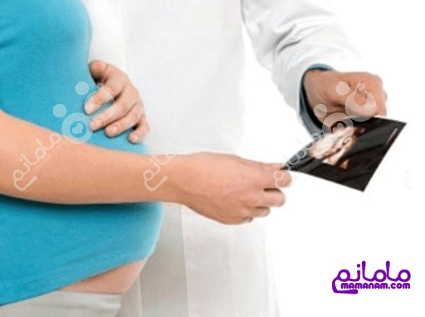 بارداری بعد از سقط جنین و مهمترین نکاتی که باید بدانید