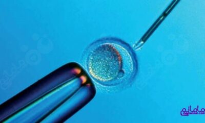 11 مرحله IVF یا لقاح آزمایشگاهی (بخش دوم)