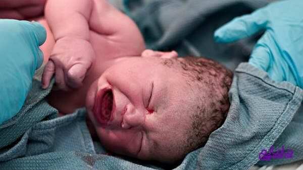 آیا نمره تست آپگار نوزادم 10 است؟