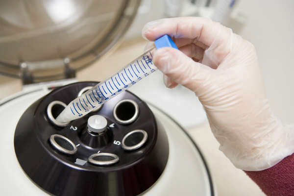 ivf 5