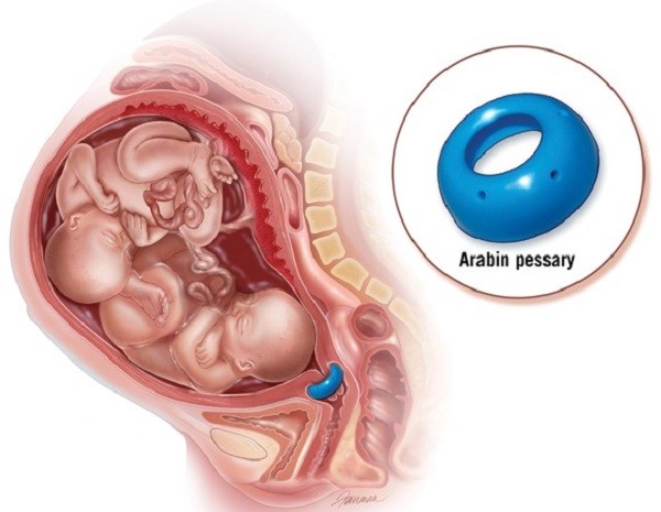 b2ap3 large progesterone1