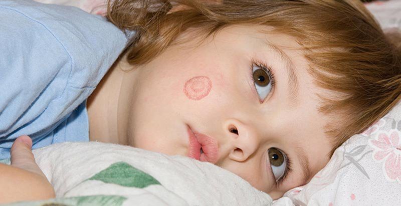 b2ap3 large germ 1532427109 86471