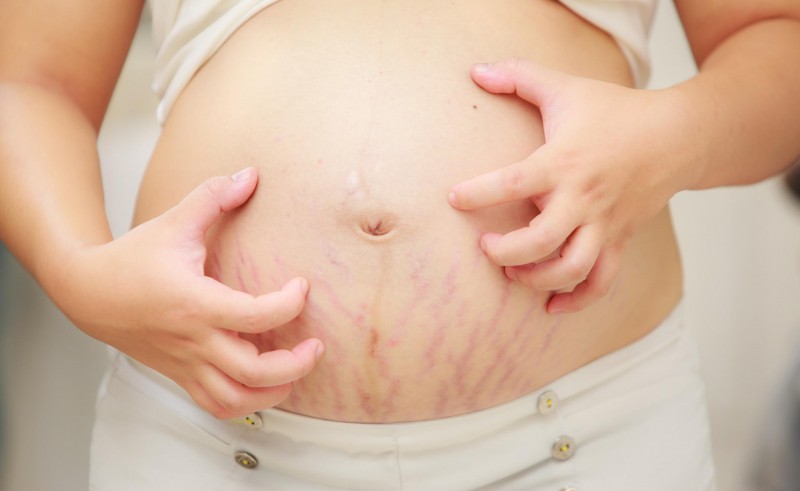 b2ap3 large pregnant with pupp belly rash1 1534321231 60870