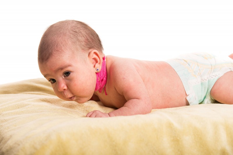 b2ap3 large torticollis 1534430368 29930