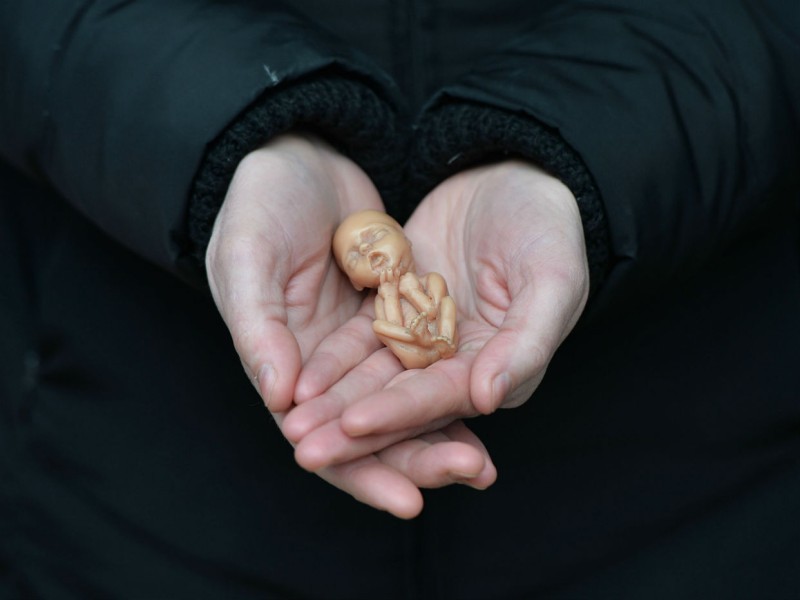 b2ap3 large wd abortion