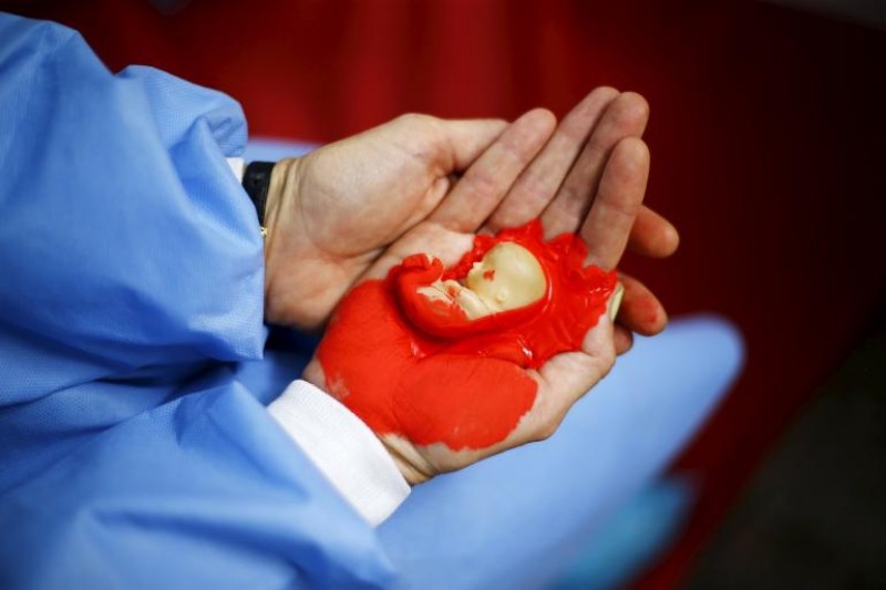 b2ap3 large woman holds fake fetus during rally against draft law chilean government which seeks legalize