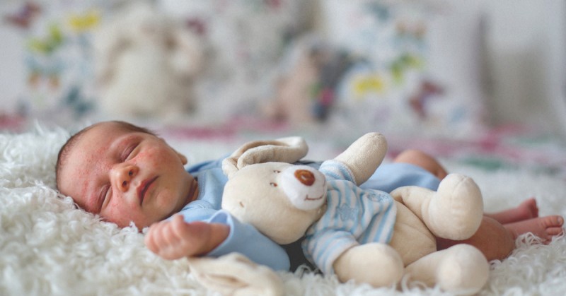 b2ap3 large 4335 baby with skin rash acne 1200x628 Facebook