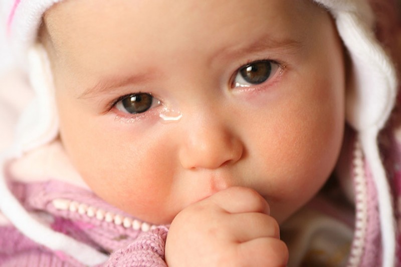 b2ap3 large Watery Eyes In Babies