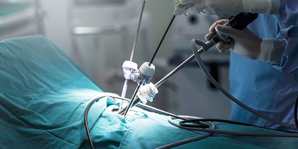 what Laparoscopy