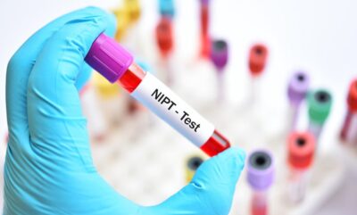 آزمایش NIPT اجباری است؟ | تحلیل نتیجه آزمایش غربالگری