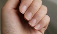 راهنمای کامل درمان ناخن های شکننده و تقویت آن ها در تیر 1405